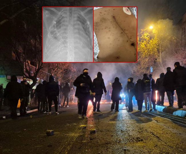 روایت پزشکان از قتل مجروحان اعتراضات در بیمارستان‌ها؛ «بیمار را از آی‌سی‌یو به سردخانه می‌بردند»